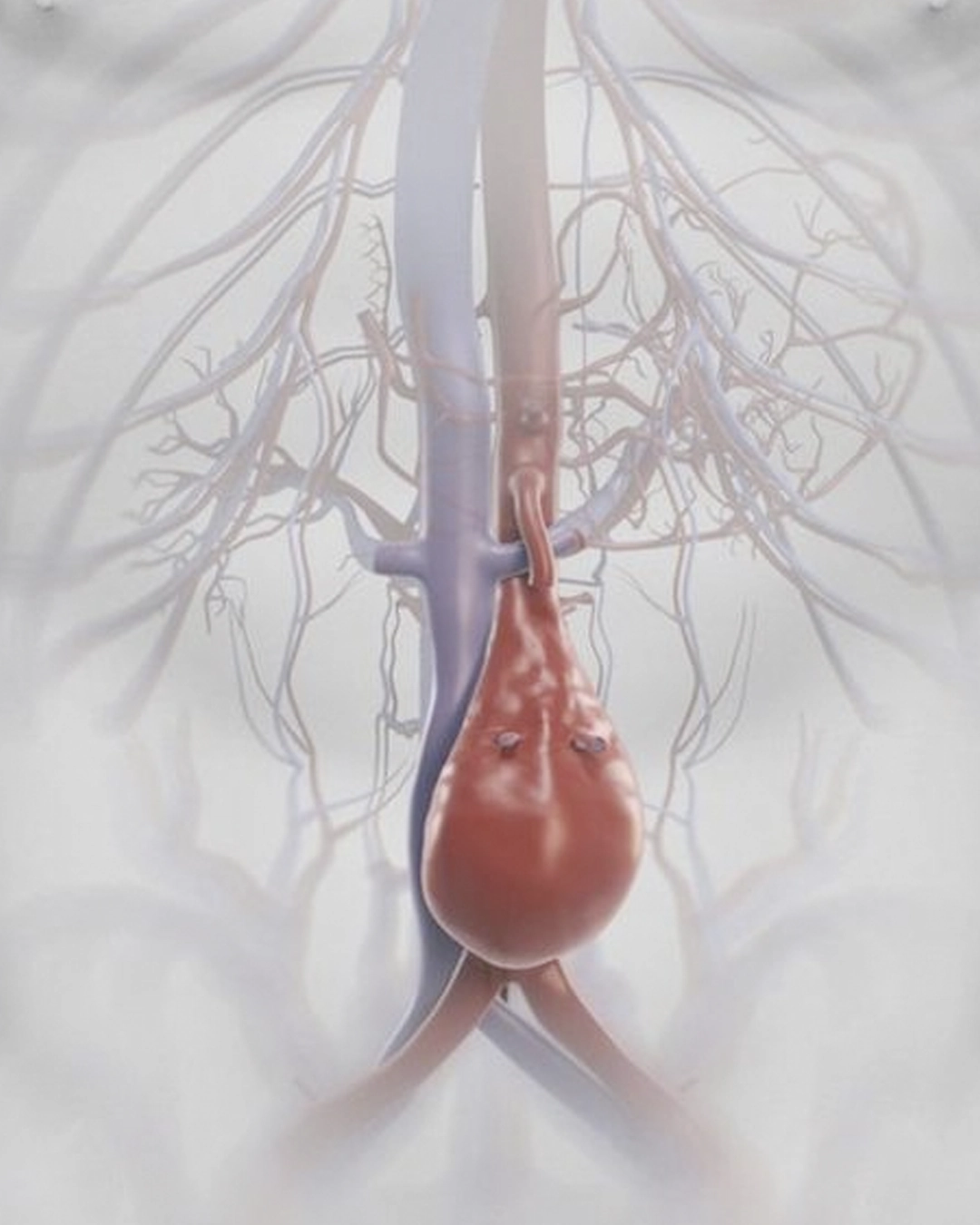Aorta screening ultrasound