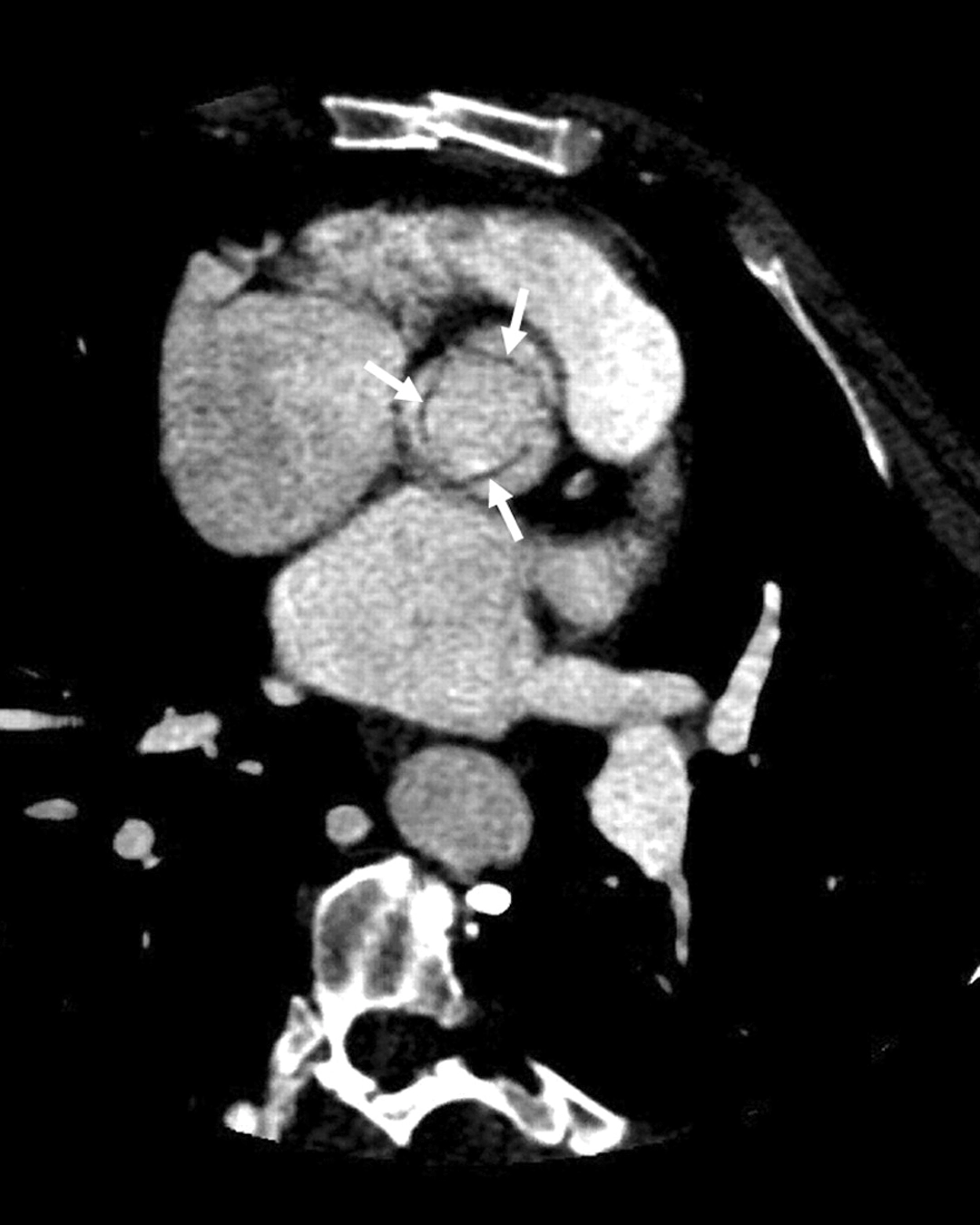 Cardiac valve and heart function evaluation