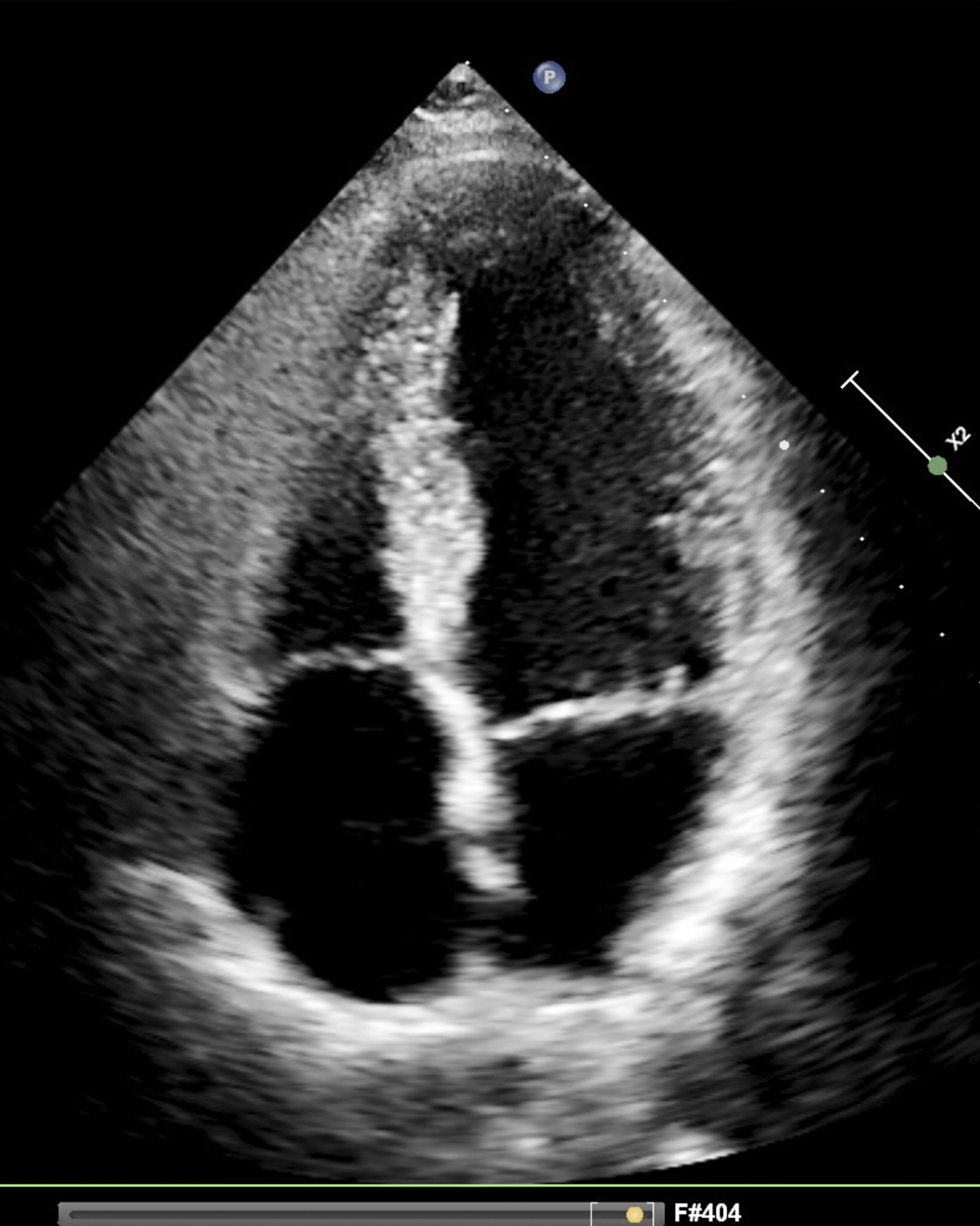 Heart ultrasound review