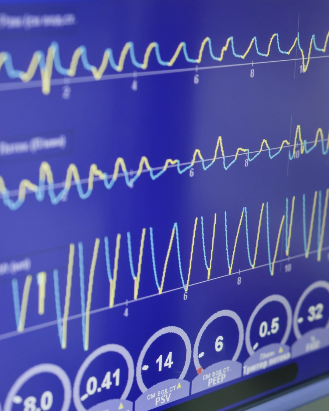 EKG testing for heart rhythm evaluation