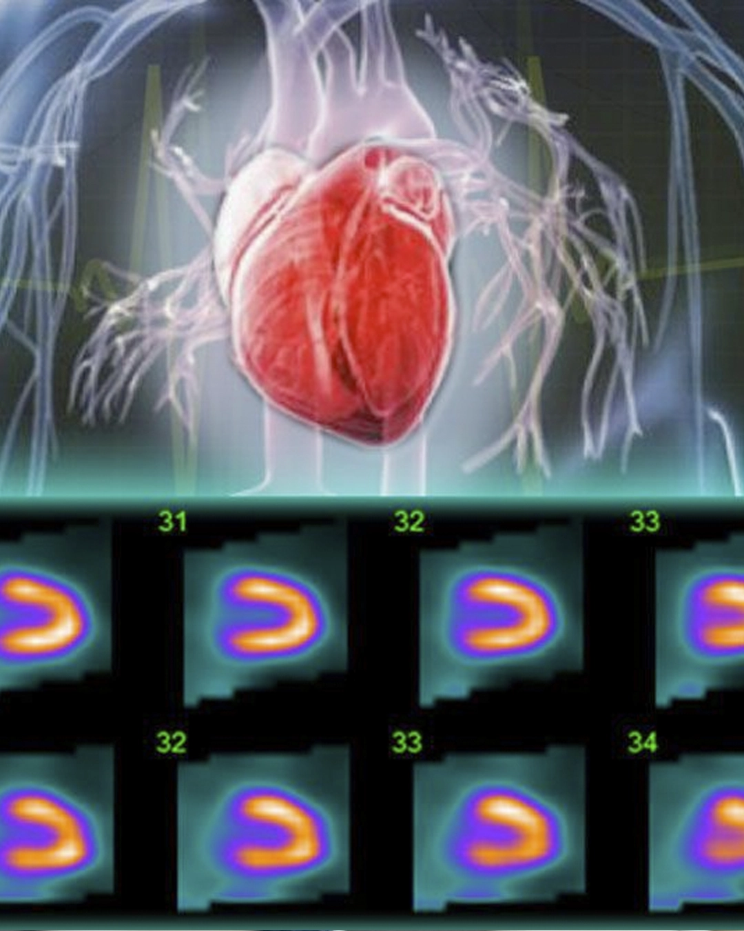 Cardiac stress imaging