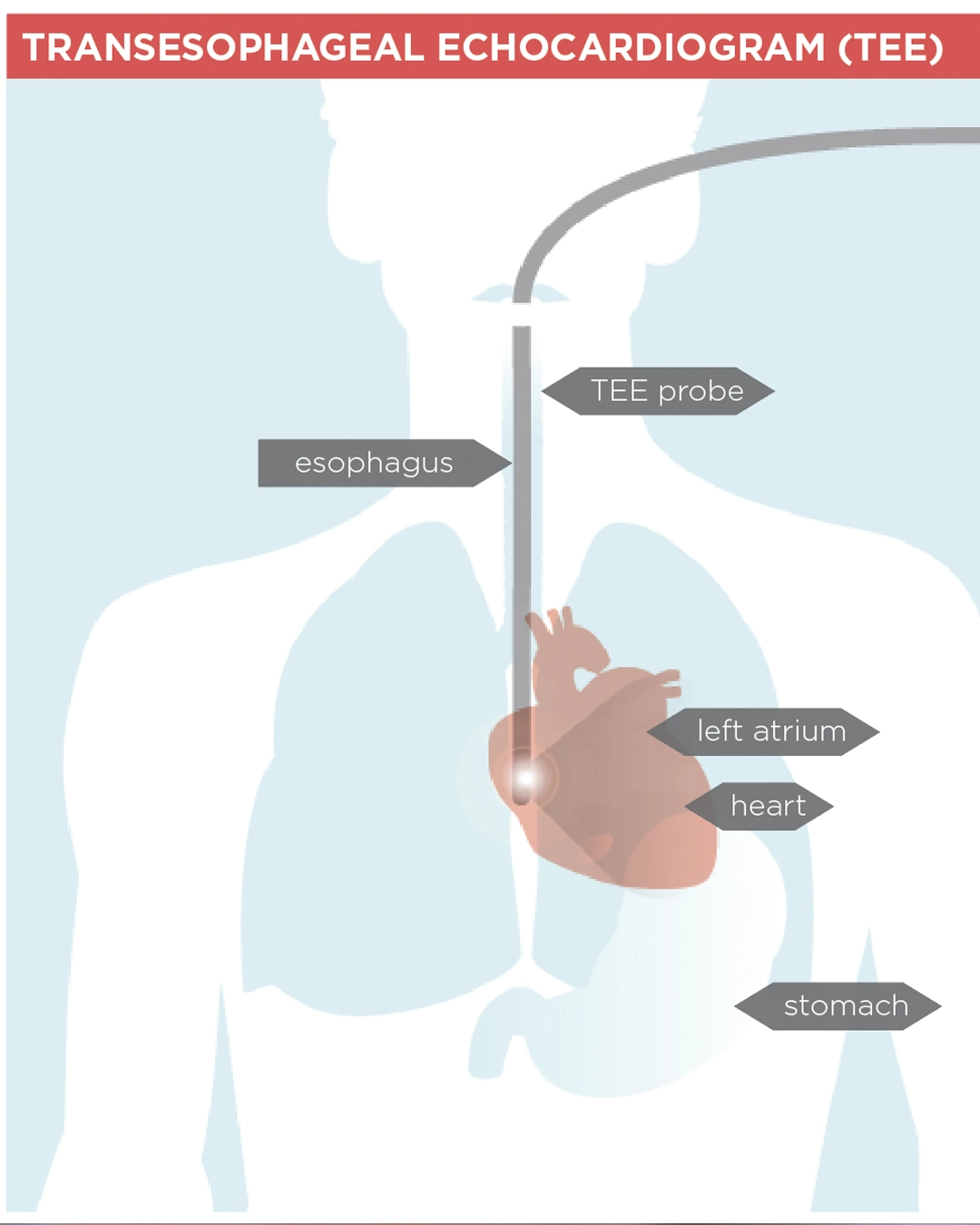 TEE cardiac imaging