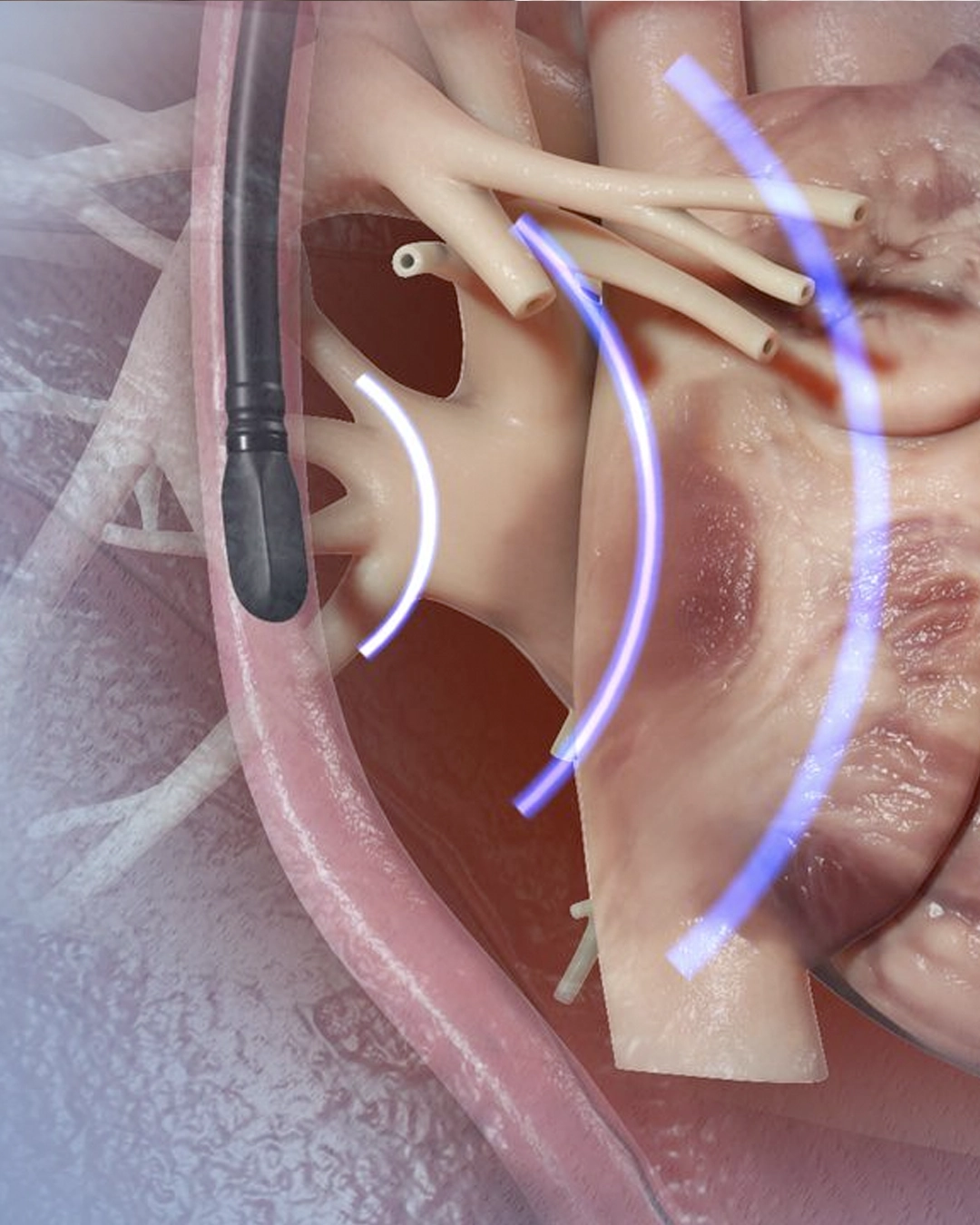 Transesophageal echocardiogram procedure coordination
